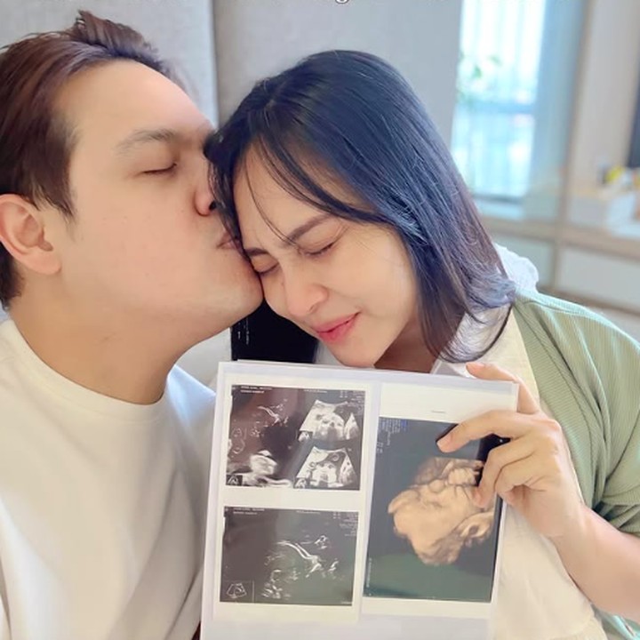 <p>Thana dan suami juga sempat mengunggah foto hasil USG kehamilan ketiga ke publik. Dalam unggahan ini, keduanya berbagi momen mesra sambil meminta doa untuk kelancaran proses kehamilan. "Doain lancar semua sampai lahiran yaa," tulisnya. (Foto: Instagram @aviwkila)</p>