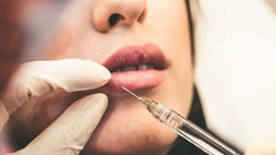 Benarkah Botox di Usia 20-an Efektif Cegah Kerutan? Ini Kata Ahli