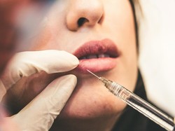 Benarkah Botox di Usia 20-an Efektif Cegah Kerutan? Ini Kata Ahli