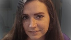 Pertama di Dunia, Wanita Kendalikan Komputer Lewat Chip di Otak