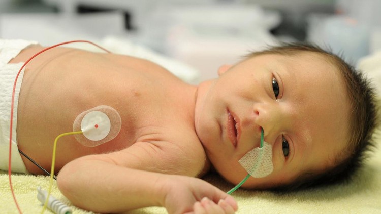 Bilirubin bayi tinggi