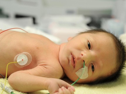 Ketahui Tingkat Bilirubin Normal Bayi Baru Lahir