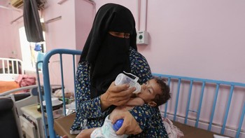 FOTO: Pilu Bayi-bayi Gaza Kelaparan Sampai Separah Ini Gegara Israel