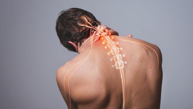 Jika tidak ditangani dengan tepat, saraf kejepit bisa memicu komplikasi serius, mulai dari kelumpuhan hingga gangguan pada organ vital seperti jantung.