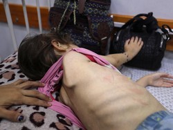 Dialami Banyak Anak di Gaza, Ini yang Terjadi pada Tubuh Saat Kelaparan