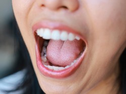 5 Tanda Masalah Kesehatan yang Bisa Diungkap dari Lidah