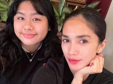 Terpopuler: Potret Amel Anak Ussy Sulistyawati yang Kuliah Kedokteran Hewan