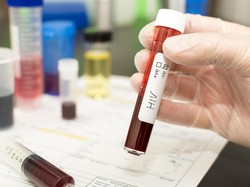 Data Terbaru Wilayah dengan Kasus HIV Tertinggi di Indonesia 2025 dan Upaya Pencegahan