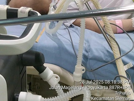 Dhafita, Pejuang Kecil dengan Hidrosefalus, Epilepsi hingga Cerebral Palsy