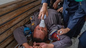 Kapolsek Pati Kota Terluka, Dirawat di RS Usai Amankan Demo Bupati