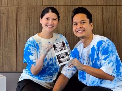 Anthony Ginting dan Istri Gelar Gender Reveal Ungkap Jenis Kelamin Anak Pertama, Intip Potretnya
