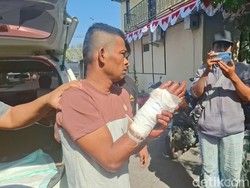 Detik-detik Paman Gorok Bocah 4 Tahun di Bangkalan Pakai Parang