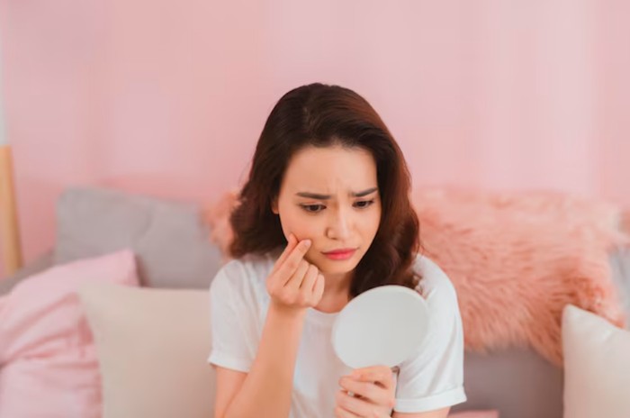 Penyebab di balik PIE dan PIH. Bisa dipicu kebiasaan sehari-hari/Foto: freepik.com/makistock