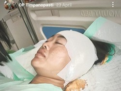 Gendang Telinga Warga Malang Berlubang gegara Sering Pakai Cotton Bud
