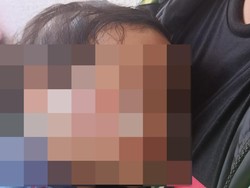 Ortu Anak 1 Tahun Penuh Luka di Daycare Surabaya Lapor Polisi