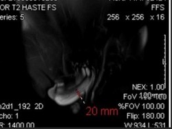 Krek! Dokter Tangani Kasus Mr P Patah saat Bercinta, Berujung Jalani Operasi