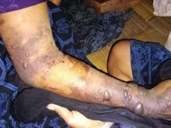 7 Warga Suku Baduy Tewas Akibat Gigitan Ular Tanah, Terlambat Dibawa ke RS