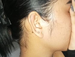 Kades di Sumenep Dilaporkan Perempuan Muda Atas Dugaan Penganiayaan
