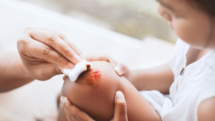 Antiseptik Ini Terbukti Efektif dalam Menangani Luka Terbuka, Ini Kata Dokter