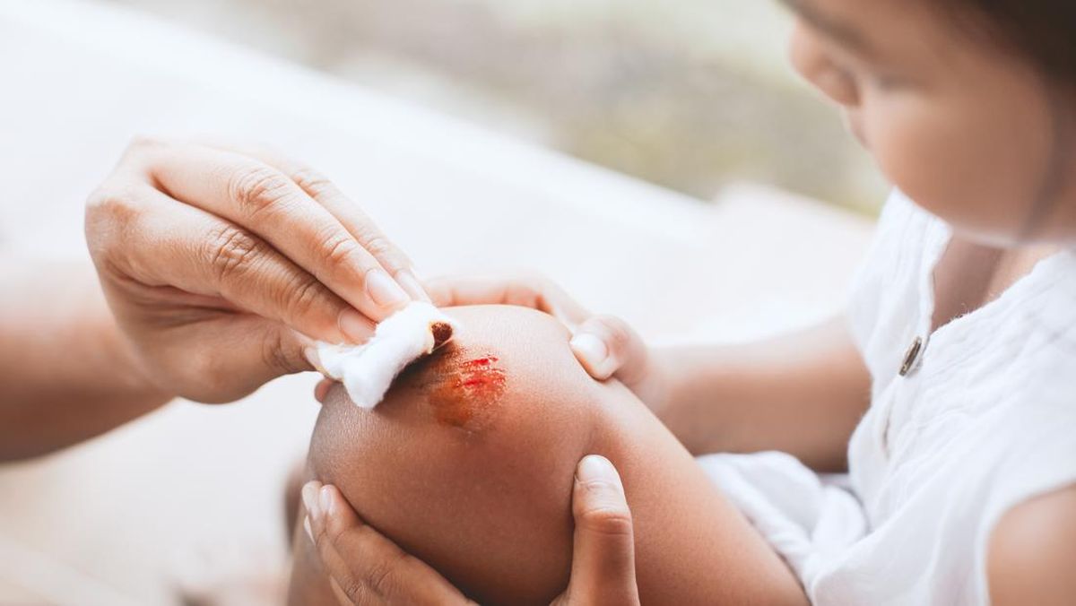 5 Cara Menyembuhkan Luka Tanpa Obat, Cukup Pakai Bahan Dapur