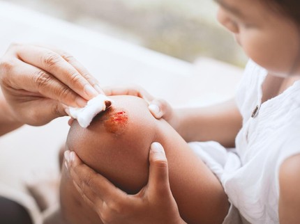 5 Cara Merawat Luka pada Anak agar Cepat Sembuh Menurut Dokter