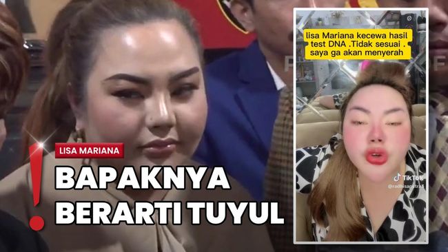 Tak Terima Hasil Tes DNA RK, Lisa Mariana Ancam Bongkar Hal Lain