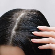 Ketahui 7 Penyebab Uban Muncul di Usia Muda