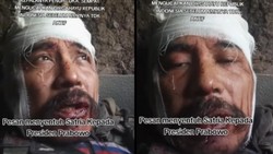 Eks Marinir Satria Kumbara Luka Serius Akibat Serangan Mortir di Ukraina, Mohon Doa dari Indonesia