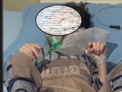 Miris! Bocah 4 Tahun di Palembang Alami Gizi Buruk, Ortu Susah Urus KIS