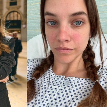 Cerita Perjuangan Barbara Palvin Lawan Endometriosis: Diagnosis Dini Sangat Penting!
