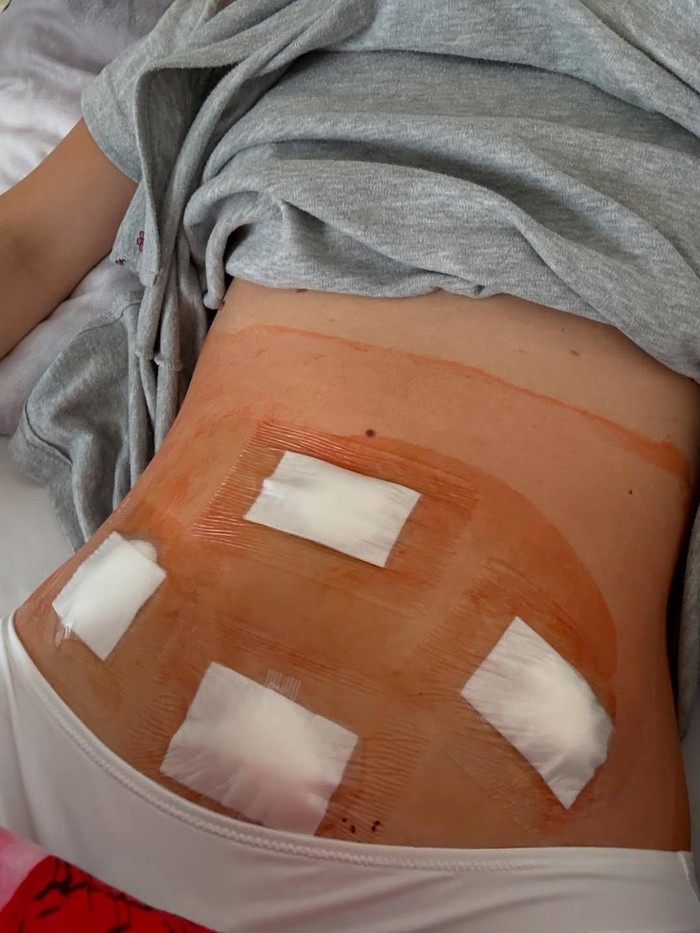 Diagnosis Dini Penting untuk Mencegah Komplikasi/ Foto: instagram.com/realbarbarapalvin