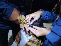 Rambut Siswi TK di Bogor Terlilit Sisir, Ortu Datangi Damkar