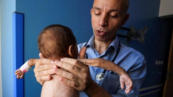 FOTO: Makin Pilu, Anak-anak Malnutrisi Banjiri RS di Gaza