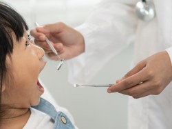 90 Persen Anak RI Alami Karies Gigi, Kenali Pemicu dan Cara Mengatasinya