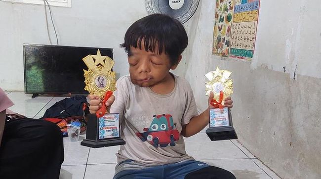 Salurkan bantuan Anda untuk Ilyas yang mengalami tumor getah bening agar bisa sembuh dan bersekolah lagi tanpa takut di-bully.