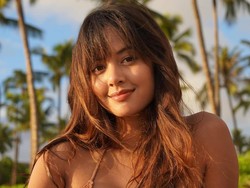 Aurelie Moeremans 13 Minggu, Masih Jalani Terapi Imbas Kecelakaan Mobil