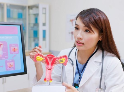 Tes Swab, Terobosan Baru untuk Deteksi Kanker Rahim Lebih Cepat