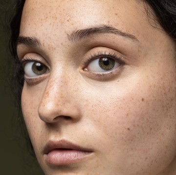 Timbul Bintik Hitam di Wajah? Ini Penyebab dan Cara Menghilangkannya yang Aman & Efektif