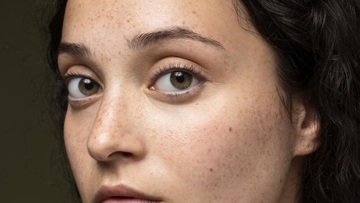 Timbul Bintik Hitam di Wajah? Ini Penyebab dan Cara Menghilangkannya yang Aman & Efektif