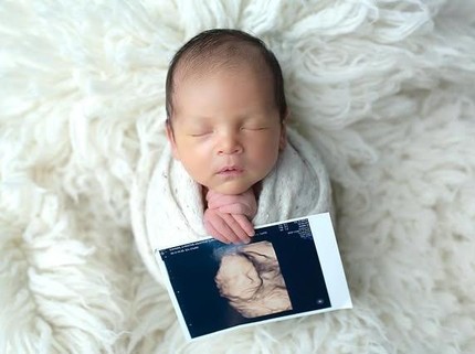 Kisah Bayi Pertama Lahir dari Rahim Transplantasi Donor yang Telah Meninggal