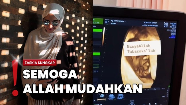 Zaskia Sungkar Hamil Anak Kedua, Pamer Baby Bump di Trimester Kedua