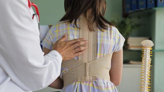 Kenali Ciri-ciri Skoliosis pada Anak dan Cara Mendeteksinya Sejak Dini