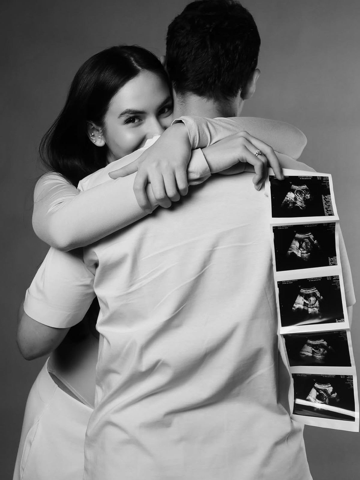 Steffi Zamora Pamer Baby Bump Umumkan Hamil Anak