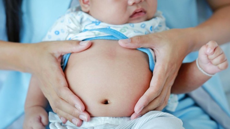 Hernia Inguinalis pada Bayi: Kenali Penyebab, Tanda, Cara Mencegah, dan Mengatasinya Hernia Inguinalis pada Bayi: Kenali Penyebab, Tanda, Cara Mencegah, dan Mengatasinya