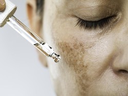 Peringatan Dermatolog, Sefatal Ini Efeknya Pakai Skincare Berkedok Putih Instan