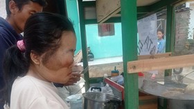 Bantu Anak Penjual Batagor Sembuh dari Tumor di Mata via Berbuatbaik