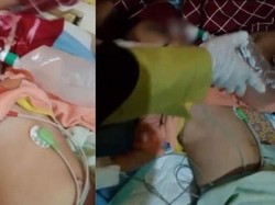 Selain Khaira, Kakaknya Berusia 4 Tahun Juga Alami Penyakit Cacingan