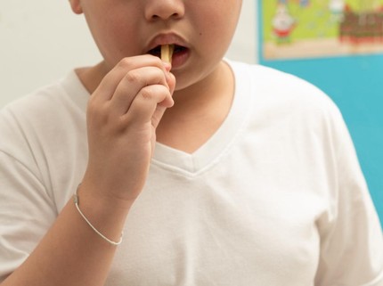 Wamenkes Wacanakan Sugar Tax, Imbas Meningkatnya Kasus Obesitas Anak di Indonesia