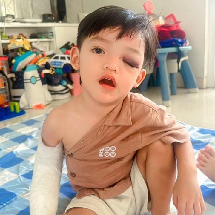 <p>Menurut Ricky, putranya memang sering berlarian usai mandi, tetapi hari itu situasi sedikit berbeda. "Pintu itu terbuka, dia sembunyi di balik pintu. Begitu di balik pintu itu, jatuh," tambahnya. (Foto: Instagram @rickyperdana06)</p>