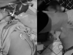 Viral Cacing Keluar dari Mulut-Hidung Balita Bengkulu, Ada Larva di Paru-parunya